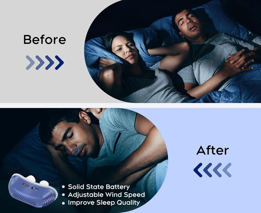 Compact Travel CPAP Sleep Apnea Device — Portable Anti-Snoring Solution, CPAP Alternative